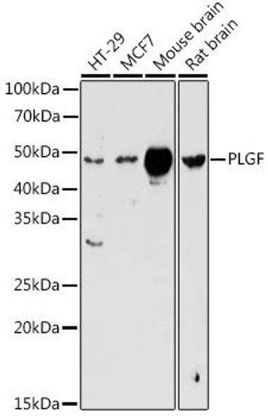 Anti-PLGF Antibody (CAB1727)