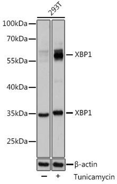 Anti-XBP1 Antibody (CAB1731)