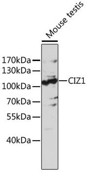 Anti-CIZ1 Antibody (CAB17349)