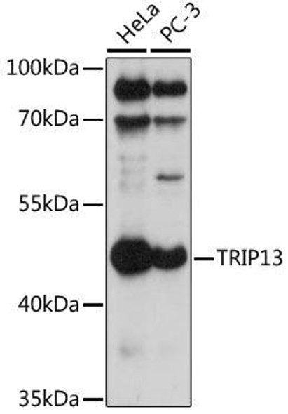 Anti-TRIP13 Antibody (CAB17357)