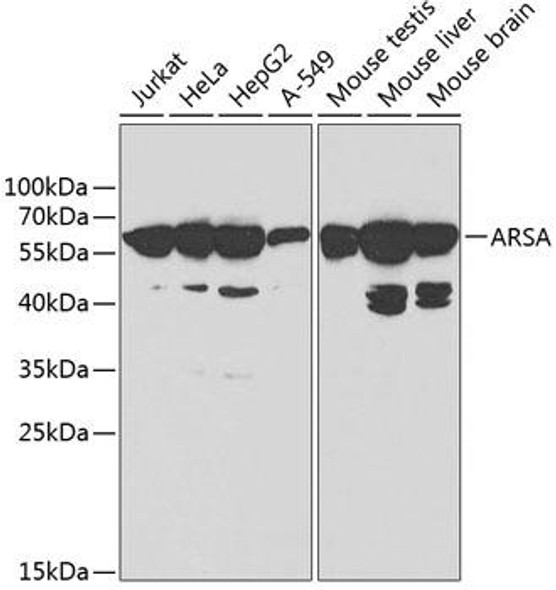 Anti-ARSA Antibody (CAB1736)