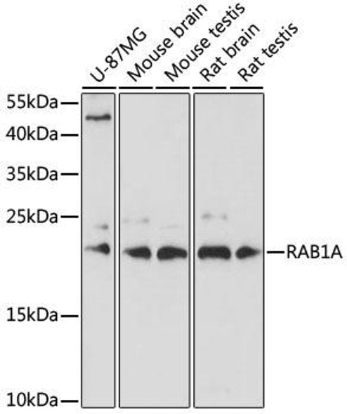 Anti-RAB1A Antibody (CAB17364)