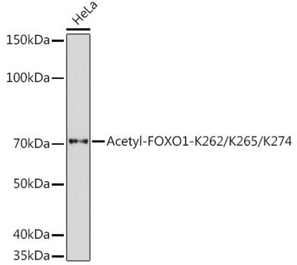 Anti-Acetyl-FOXO1-K262/K265/K274 Antibody (CAB17406)