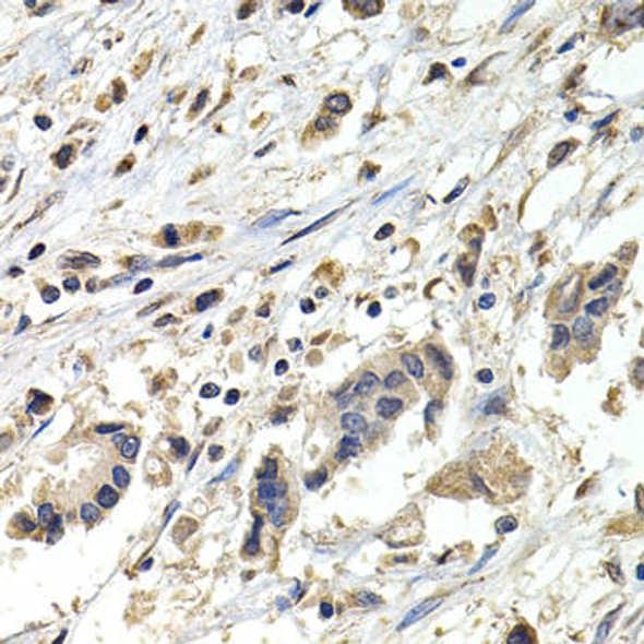 Anti-BUB1B Antibody (CAB1775)