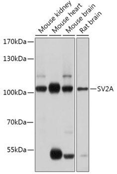 Anti-SV2A Antibody (CAB17868)