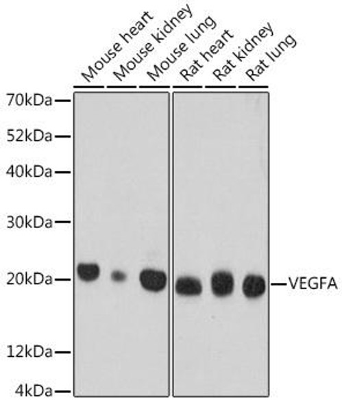 Anti-VEGF Mouse Monoclonal Antibody (CAB17877)
