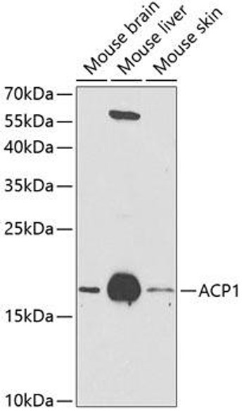 Anti-ACP1 Antibody (CAB1801)