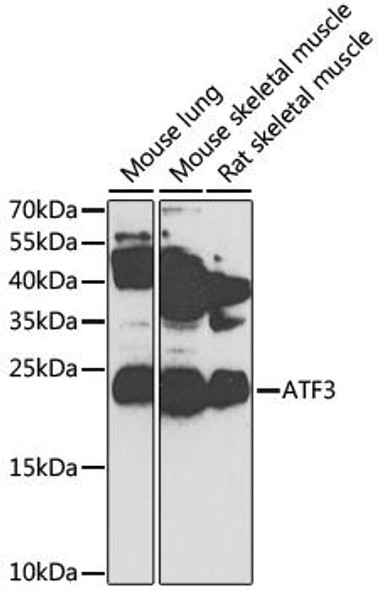 Anti-ATF3 Antibody (CAB1852)