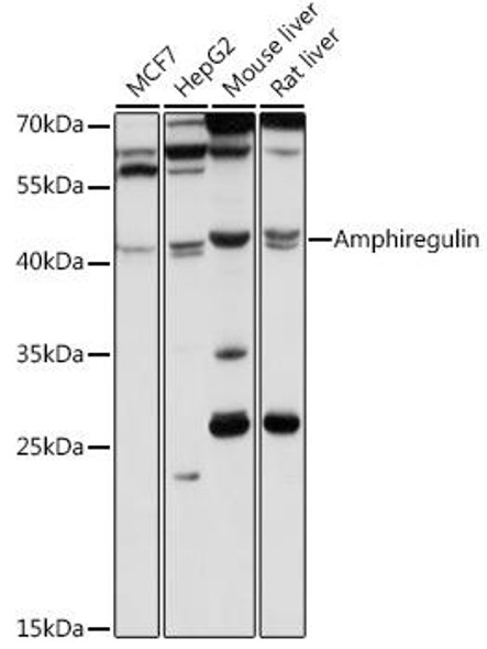 Anti-Amphiregulin Antibody (CAB1860)