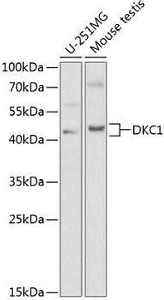 Anti-DKC1 Antibody (CAB1862)