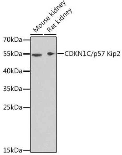 Anti-CDKN1C/p57 Kip2 Antibody (CAB2060)