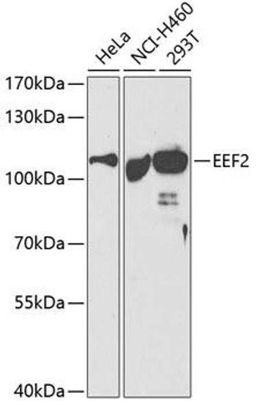 Anti-EEF2 Antibody (CAB2068)