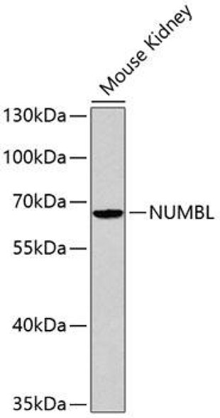Anti-NUMBL Antibody (CAB2140)