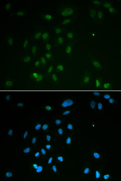 Anti-Chk2 Antibody (CAB2145)