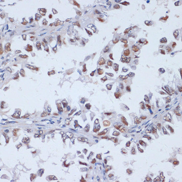 Anti-DNMT3L Antibody (CAB2342)