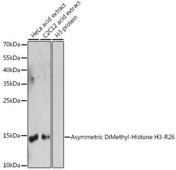 Anti-Asymmetric DiMethyl-Histone H3-R26 Antibody (CAB2375)