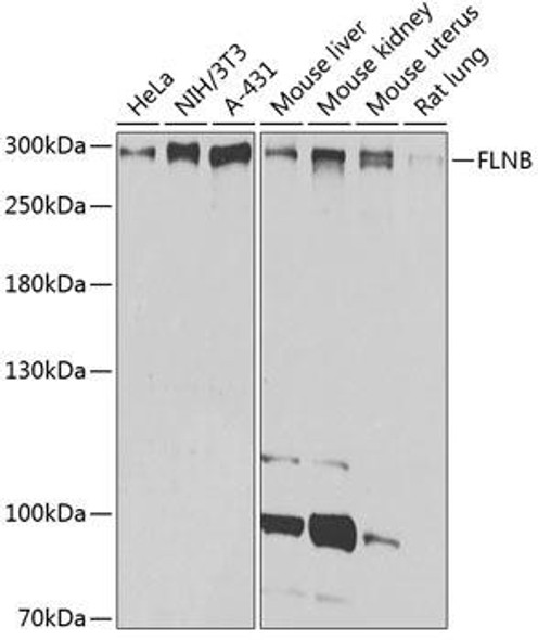 Anti-FLNB Antibody (CAB2481)