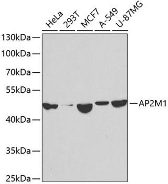 Anti-AP2M1 Antibody (CAB2492)