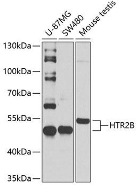 Anti-HTR2B Antibody (CAB2651)
