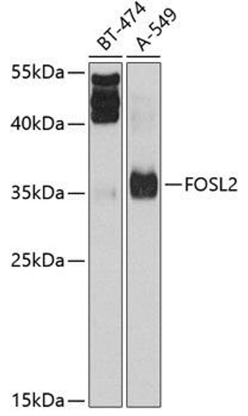 Anti-FOSL2 Antibody (CAB2729)
