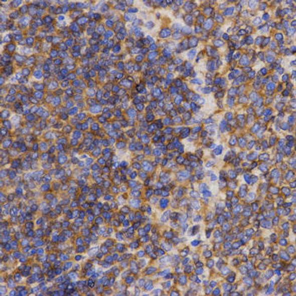 Anti-PDCD10 Antibody (CAB2786)