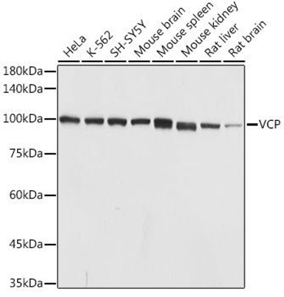 Anti-VCP Antibody (CAB2795)