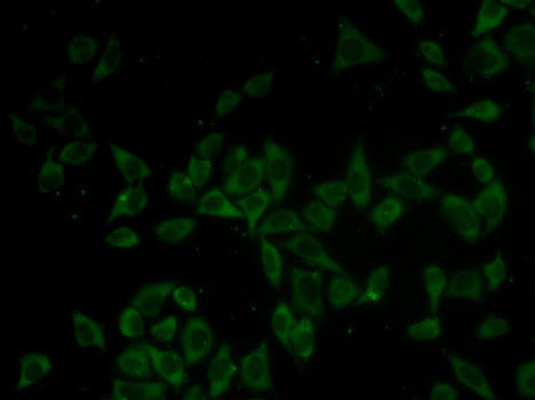 Anti-DNM1 Antibody (CAB2902)