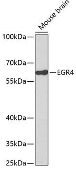 Anti-EGR4 Antibody (CAB2910)