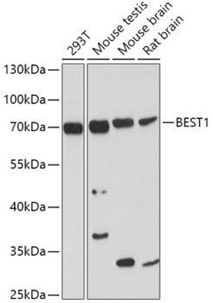 Anti-BEST1 Antibody (CAB3022)