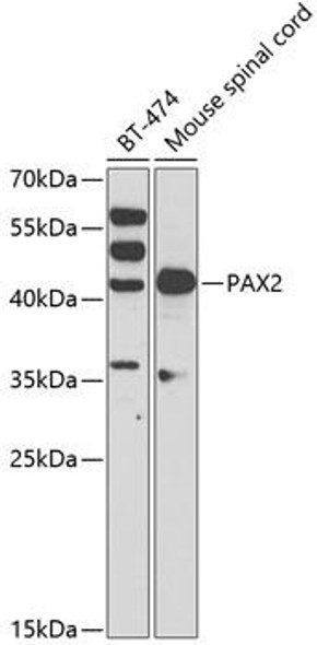 Anti-PAX2 Antibody (CAB3067)