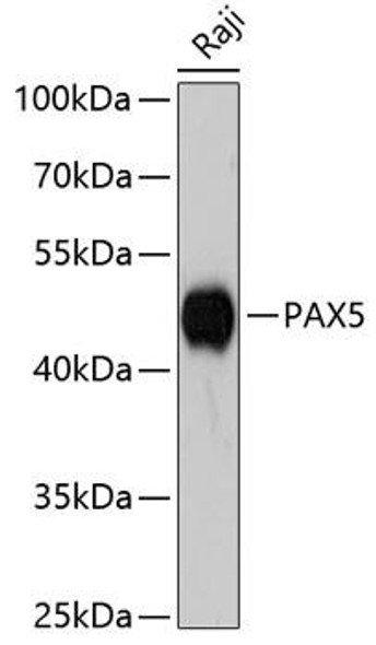 Anti-PAX5 Antibody (CAB3068)