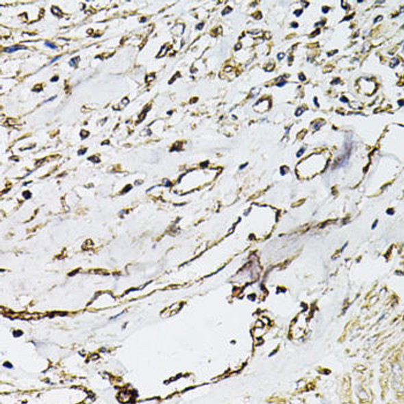 Anti-CD31/PECAM1 Antibody (CAB3181)