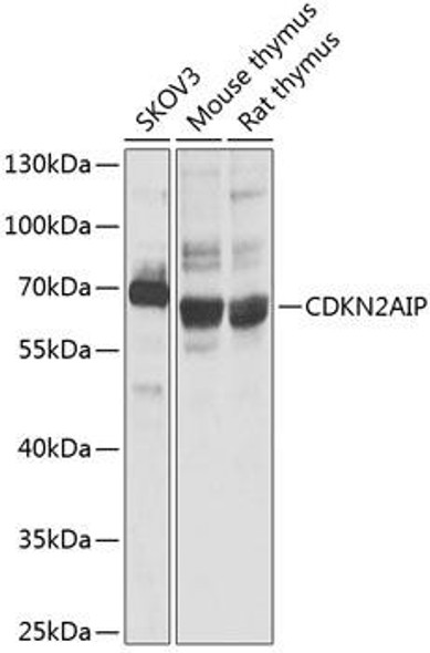 Anti-CDKN2AIP Antibody (CAB3233)