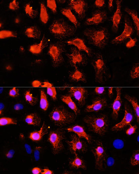 Anti-ACTN2 Antibody (CAB3718)