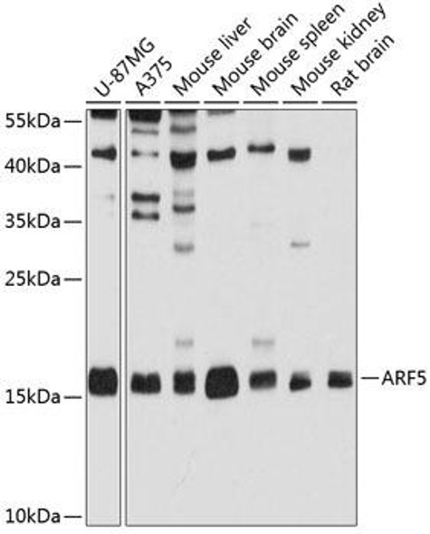 Anti-ARF5 Antibody (CAB3737)