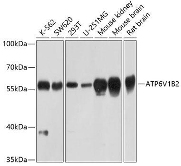 Anti-ATP6V1B2 Antibody (CAB3754)