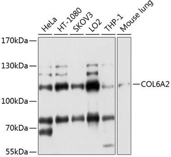 Anti-COL6A2 Antibody (CAB3796)