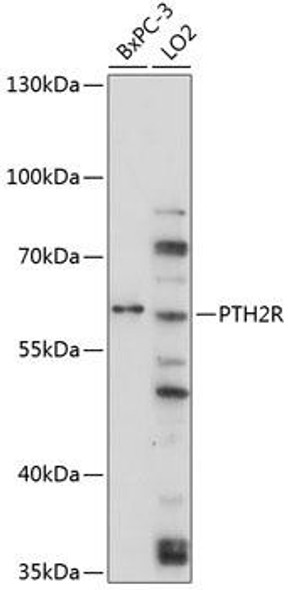 Anti-PTH2R Antibody (CAB4058)