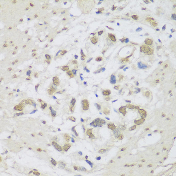 Anti-DHX38 Antibody (CAB4341)