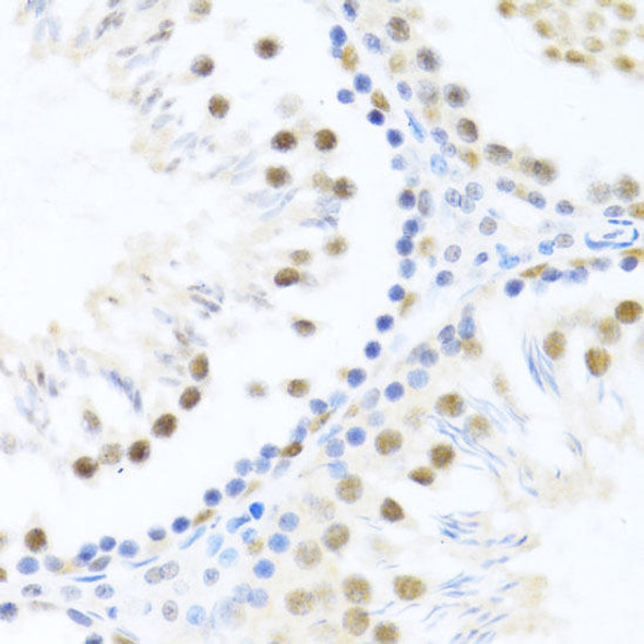 Anti-DDX46 Antibody (CAB4350)