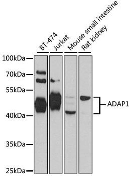 Anti-ADAP1 Antibody (CAB4479)