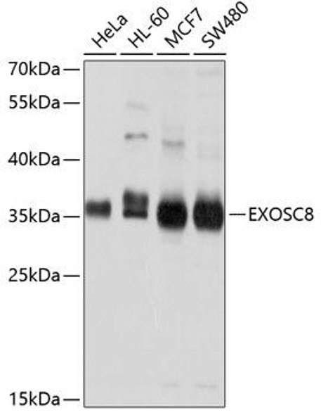 Anti-EXOSC8 Antibody (CAB4507)