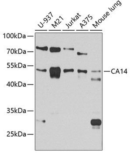 Anti-CA14 Antibody (CAB4573)