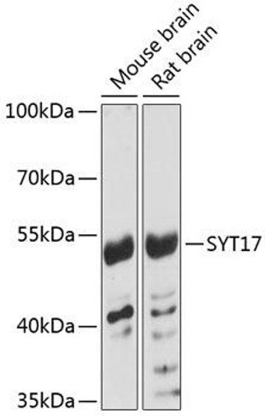 Anti-SYT17 Antibody (CAB4764)