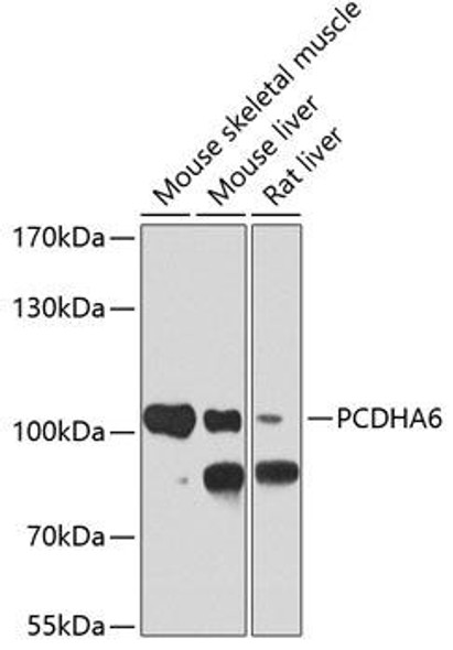 Anti-PCDHA6 Antibody (CAB4856) Anti-PCDHA6 Antibody (CAB4856)