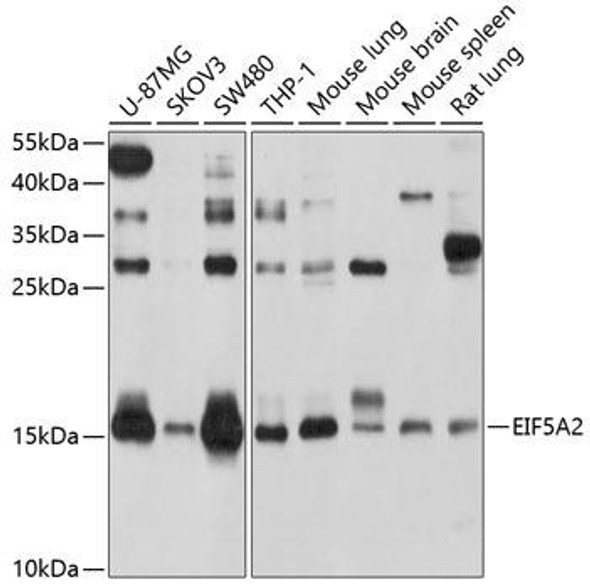 Anti-EIF5A2 Antibody (CAB4864)