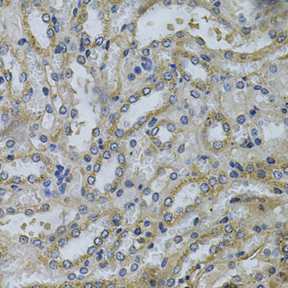 Anti-SERPINE2 Antibody (CAB5329)