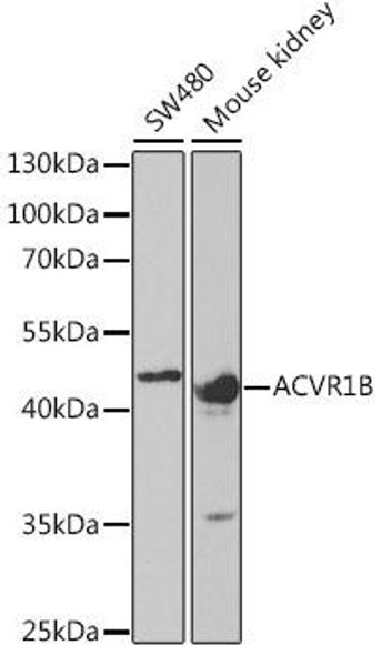 Anti-ACVR1B Antibody (CAB5453)