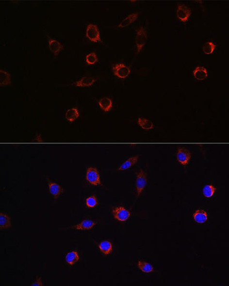 Anti-APLP2 Antibody (CAB5455)