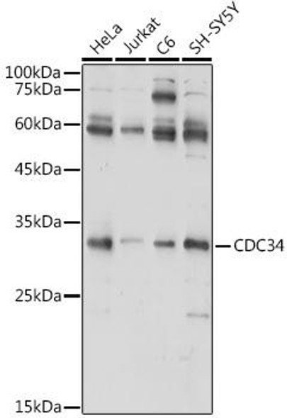Anti-CDC34 Antibody (CAB5457)